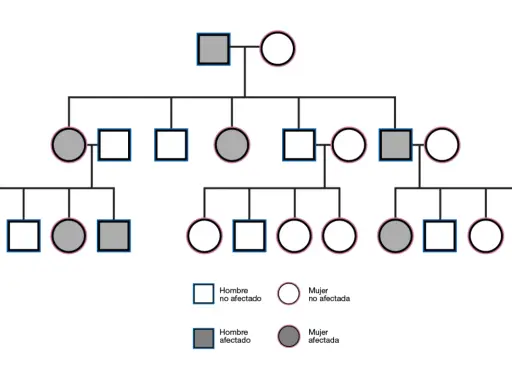 Árbol genealógico que muestra la herencia dominante. Individuos afectados (cuadrados y círculos grises) y no afectados (cuadrados y círculos blancos) a través de varias generaciones.
