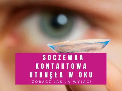 Nie mogę znaleźć soczewki w oku? Zobacz, jak wyjąć soczewkę kontaktową, która utknęła w oku.