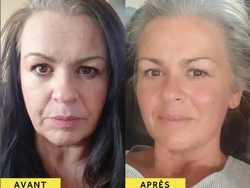 Avant/Après : une femme avant et après avoir pris du collagène. Sa peau semble plus lisse et radieuse.