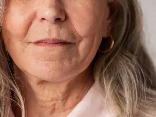 Gros plan sur le visage d'une femme âgée, montrant les rides autour de la bouche et du cou. Des conseils sur comment faire disparaître les rides profondes pourraient être utiles.