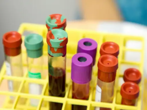 Probówki z krwią w żółtym stojaku laboratoryjnym.