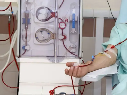 Pacjent podłączony do sztucznej nerki, która oczyszcza jego krew. Widoczne przewody i aparat do dializy.