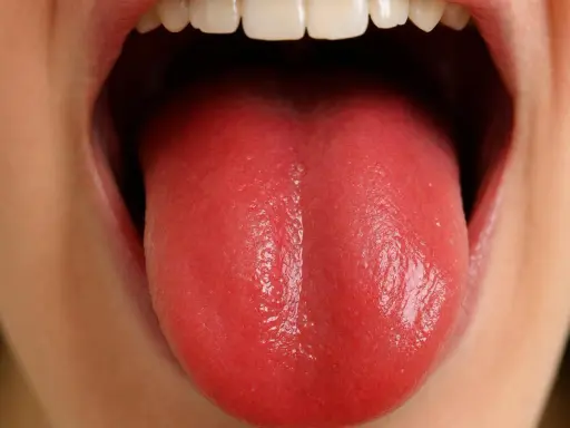 Lingua rossa lucida, un segno che potrebbe indicare cambiamenti nella salute, anche negli anziani.