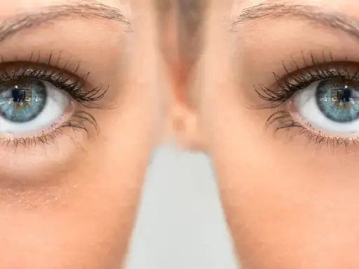 Gros plan sur des yeux bleus, montrant des poches sous les yeux. Le bicarbonate de soude est une astuce maison pour les atténuer.