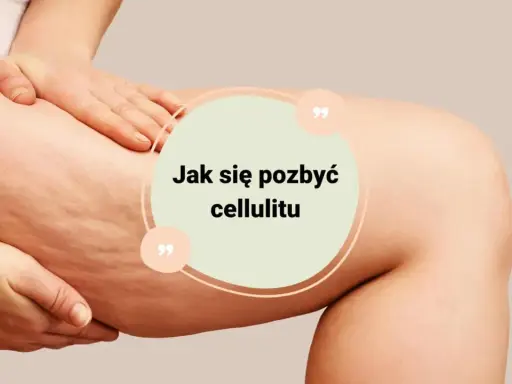 Jak pozbyłam się cellulitu? Mój 4-filarowy plan, który działa!