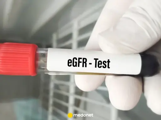 Rękawiczka trzyma probówkę z oznaczeniem "eGFR - Test". To ważny element badania gfr, oceniającego pracę nerek.