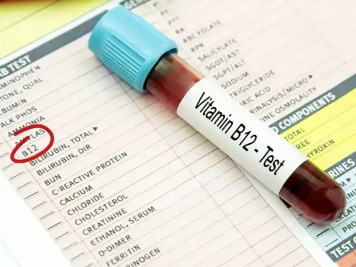 Próbówka z krwią do testu witaminy B12 leży na karcie wyników badań. Czerwone kółko zaznacza pozycję "B12", sugerując diagnostykę niedoboru B12 ICD 10.