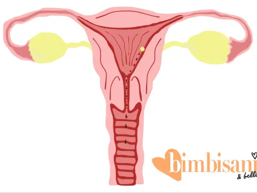 Illustrazione utero con ovuli gialli e macchie marroni, suggerendo spotting gravidanza colore.