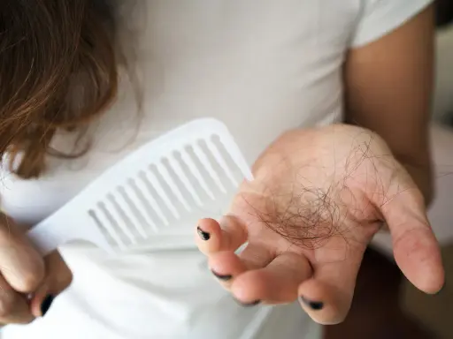 Frau hält Kamm und Haarbüschel in der Hand. Ein häufiges Problem: 4 Monate nach Geburt Haarausfall.