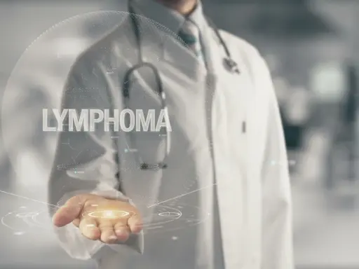 Lekarz prezentuje wirtualną kulę z napisem "LYMPHOMA", symbolizującą postęp w leczeniu chłoniaka grudkowego.