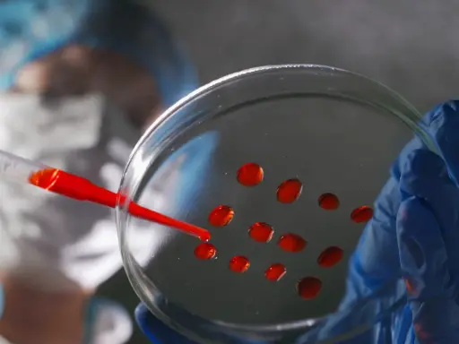 Ricerca medica: gocce rosse su piastra di Petri, parte di un test per capire se hai un tumore.