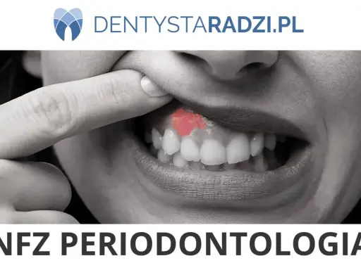 Zbliżenie na usta z widocznym zaczerwienieniem na dziąśle, sugerującym problem z paradontozą. Leczenie jest kluczowe.