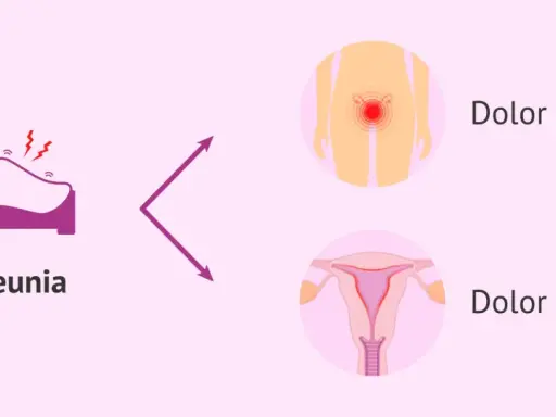 Dispareunia: dolor al ser penetrada, ya sea externo o interno.
