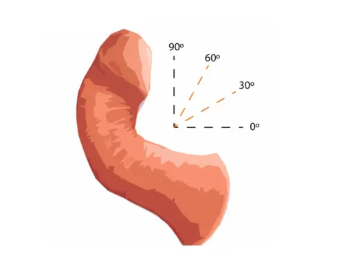 Ilustracja przedstawia prącie z zaznaczonymi kątami (0°, 30°, 60°, 90°), co może być związane z oceną uszkodzenia prącia objawy.