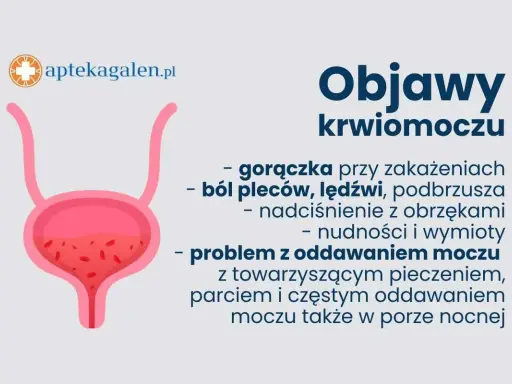 Grafika przedstawia pęcherz moczowy i objawy krwiomoczu: gorączkę, ból pleców, nudności, wymioty i problemy z oddawaniem moczu.