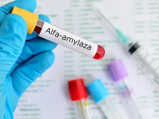 Amylaza podwyższona: co oznacza? Kiedy pilnie do lekarza?