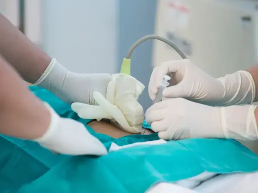 Lekarze w rękawiczkach wykonują amniopunkcję, badanie płynu owodniowego, które odpowiada na pytanie: amniopunkcja co to.
