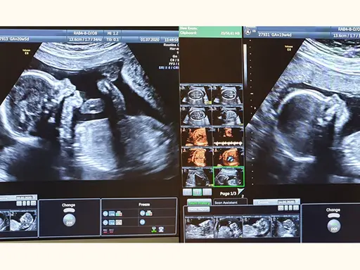 Badania prenatalne I trymestr: Co musisz wiedzieć? (do 70 znaków)