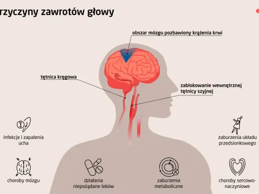 Ilustracja przedstawia przyczyny zawrotów głowy: blokadę tętnicy szyjnej, problemy z tętnicą kręgową, choroby mózgu, infekcje ucha, zaburzenia metaboliczne, sercowo-naczyniowe, układu przedsionkowego i działania niepożądane leków.