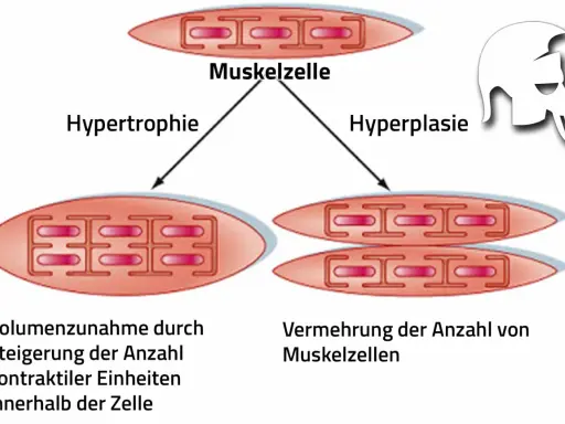 Sarkoplasmatische Hypertrophie: Muskelzelle wächst durch mehr kontraktile Einheiten. Daneben Hyperplasie: mehr Muskelzellen.