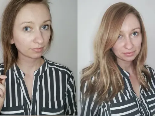 Vorher/Nachher-Vergleich: Frau mit dünnem Haar und dann vollerem, glänzenderem Haar. Hilft wirklich bei Haarausfall bei Frauen.