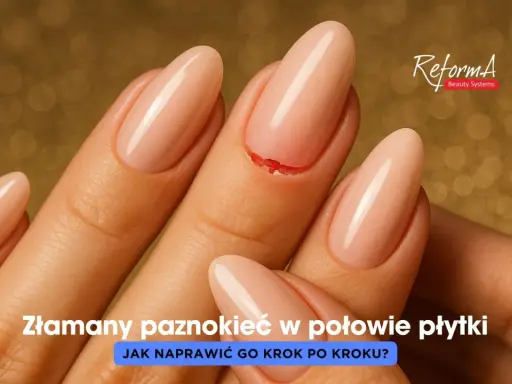Złamany paznokieć w połowie płytki, z widocznym pęknięciem. Dłoń z zadbanymi paznokciami na złotym tle.