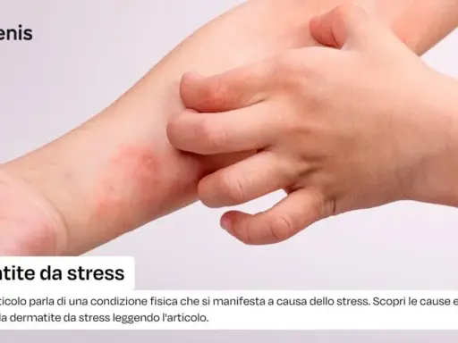 Braccio con arrossamento e sfogo cutaneo, un dito che si gratta. Potrebbe essere dermatite da stress senza prurito.