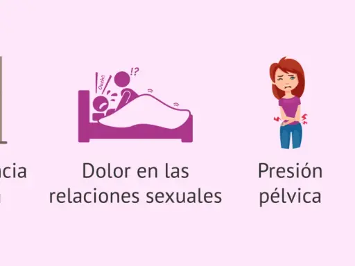 Ilustraciones de incontinencia, dolor en las relaciones sexuales, presión pélvica y lumbago, síntomas asociados al prolapso uterino.