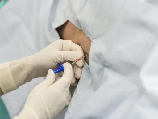 Rękawiczki medyczne zakładane są do podania znieczulenia epiduralnego.