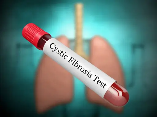 Provette con campione di sangue per il test della fibrosi cistica, con polmoni stilizzati sullo sfondo.
