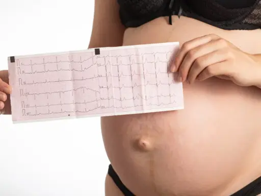 Pancia di donna incinta con elettrocardiogramma che mostra tachicardia. Monitoraggio cardiaco in gravidanza.