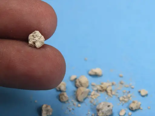 Palec trzyma niewielki kamyk, jeden z wielu złogów w nerkach 4mm, które wypadły.