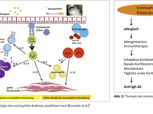 Schema zeigt eosinophile Entzündung bei Asthma: Allergene aktivieren Zellen, die zu TH2-Zellen und Eosinophilen führen. Abb. 2 zeigt Therapieansätze.