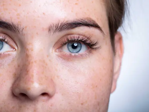 Gros plan sur un visage de femme aux yeux bleus et à la peau tachetée de rousseur. Ses cils courts et peu fournis encadrent un regard intense.