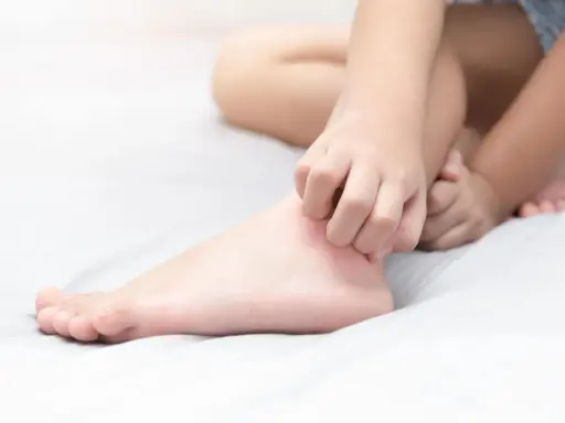 Un enfant se gratte les jambes qui démangent le soir, cherchant un peu de répit avant de dormir.