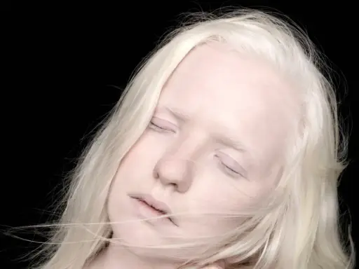 Portret albinosa z blond włosami i zamkniętymi oczami na czarnym tle.