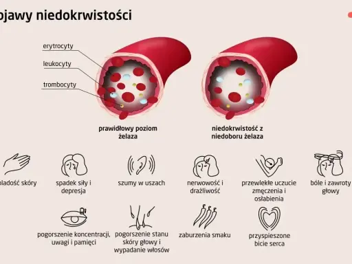Porównanie poziomu żelaza: prawidłowy vs. niedobór. Niedobór żelaza objawia się m.in. bladością skóry, zmęczeniem, bólami głowy.