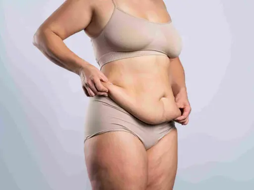Liposukcja: Co to jest? Modelowanie sylwetki bez mitów!