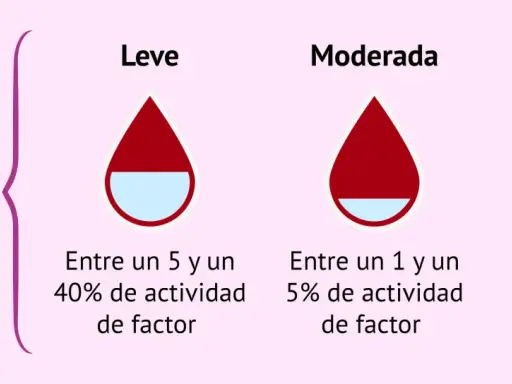 Ilustración de tipos de hemofilia: leve (5-40% actividad factor), moderada (1-5%) y grave (<1%).