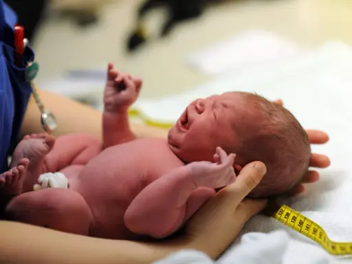 Neugeborenes Baby schreit, die Kopfform ist gut sichtbar. Ein Maßband liegt um den Kopf, wie nach einer Geburt mit Saugglocke.