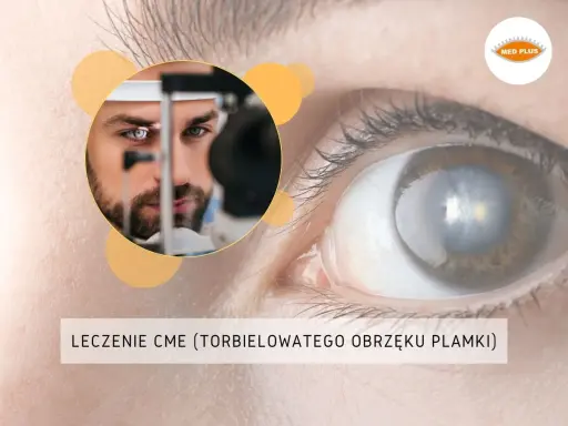 Badanie oka pod kątem makulopatii. Lekarz bada pacjenta, a na pierwszym planie widać oko z widocznymi zmianami.