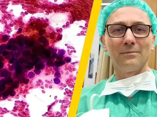 Mikroskopowe obrazy komórek rakowych i lekarz w zielonym fartuchu. Czy czwarte stadium raka ile trwa?