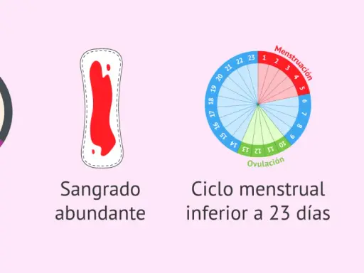 Ilustraciones sobre sangrado premenstrual: duración >8 días, sangrado abundante, ciclo corto (<23 días) y metrorragia.