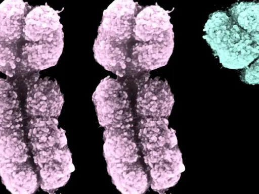 Cromosomi colorati, due rosa e uno turchese, che illustrano la sindrome XXY.
