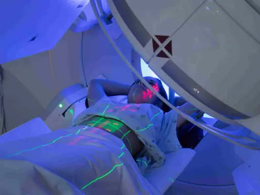 Pacjentka leży pod aparatem do radioterapii, na jej ciele widoczne są zielone i czerwone linie naprowadzające.