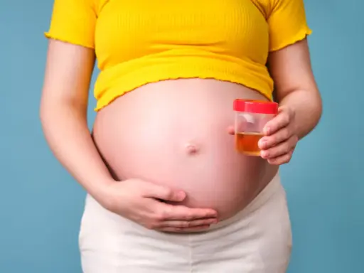 Ciężarna kobieta trzyma pojemnik z próbką moczu, badanie na obecność ketonów w moczu w ciąży.