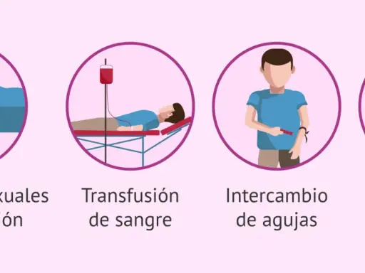 Ilustraciones muestran cómo se puede dar el contagio de clamidia: relaciones sexuales sin protección, transfusión de sangre, intercambio de agujas y embarazo.