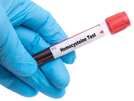 Rękawiczka z niebieskiej gumy trzyma probówkę z krwią do badania na obecność homocysteiny, która może wpływać na poziom cholesterolu.