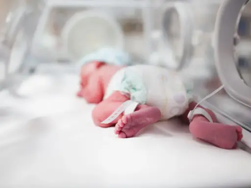 Un bebé prematuro duerme en una incubadora de bebés, con pulseras de identificación en sus tobillos.