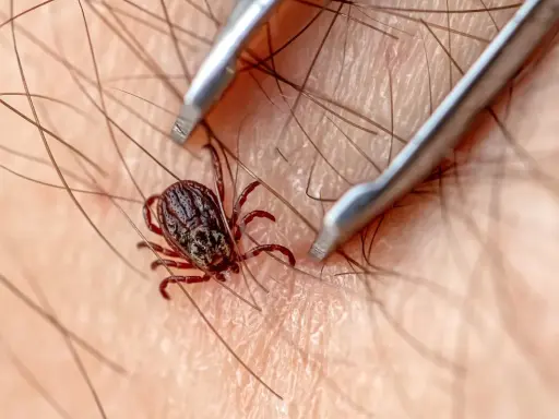 Usuwanie kleszcza: 4 kroki, narzędzia, mity. Chroń zdrowie!